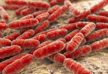 سحب جديد لبراعم الفجل في الولايات المتحدة بسبب E. coli والسالمونيلا.. FDA توسع تحذيراً غذائياً