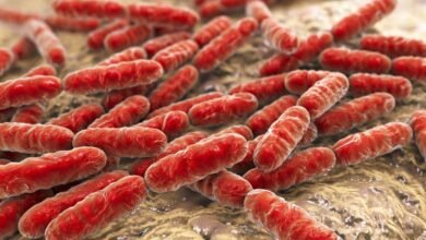 سحب جديد لبراعم الفجل في الولايات المتحدة بسبب E. coli والسالمونيلا.. FDA توسع تحذيراً غذائياً